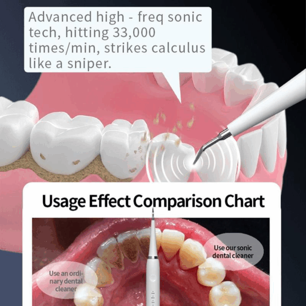 Oceantree Electric Teeth Cleaner Tartar Ultrasonic Tooth Cleaner Teeth Dental Scaler Tartar Remover Usb Electric Tooth Brush Electric Toothbrushes for Adult – Image 5